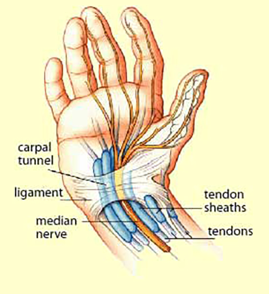 Diagram of hand, carpal tunnel, tendons