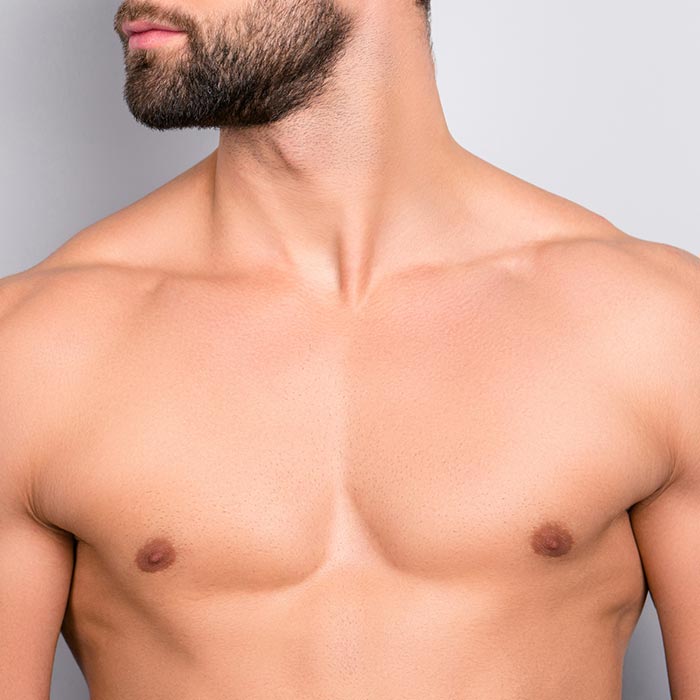 Gynecomastia at Concannon Plastic Surgery