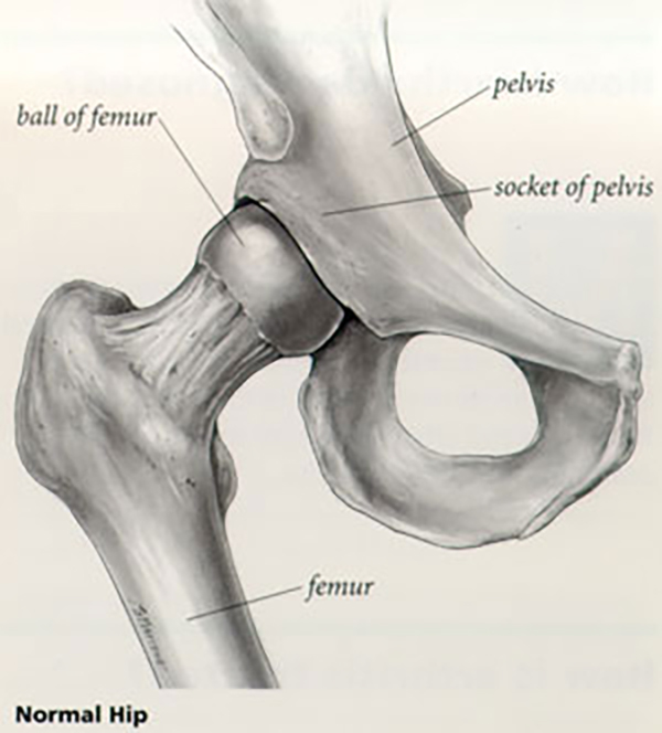 Illustration - Normal Hip: Pelvis, ball of femur, socket of pelvis