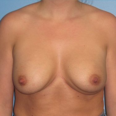 Revision of Others' Work Before Patient 6