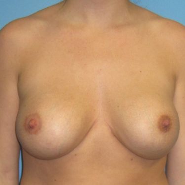 Revision of Others' Work After Patient 6