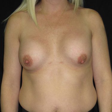 Revision of Others' Work Before Patient 1